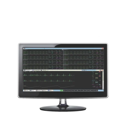 AV Central Monitoring System
