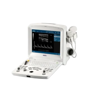AV-60 Digital Ultrasonic Diagnostic Imaging System