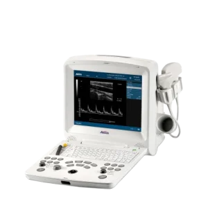 AV-60 Digital Ultrasonic Diagnostic Imaging System